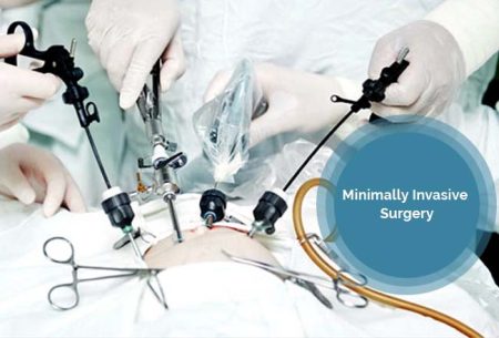 Minimal Access Surgery